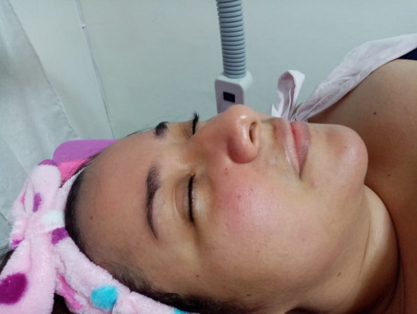 Imagen 9 de servicio