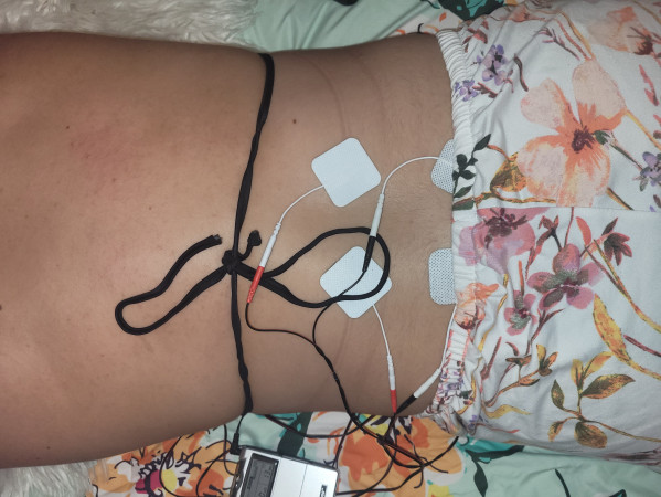 Imagen 12 de servicio