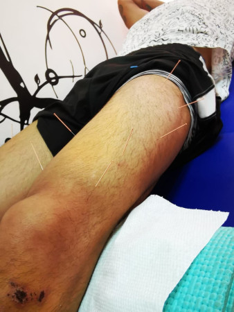 Imagen 3 de servicio