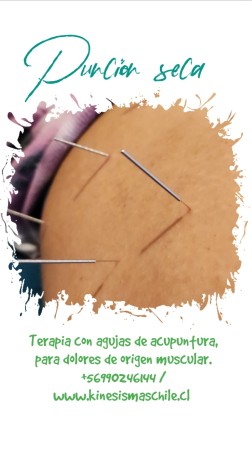 Imagen 26 de servicio