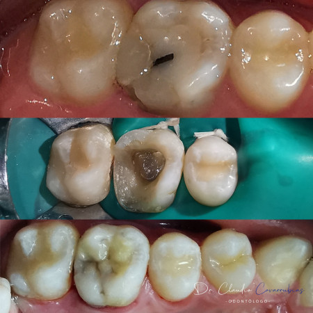 Imagen 4 de servicio