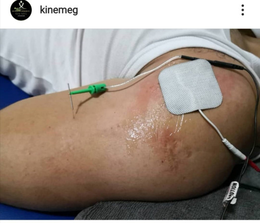 Imagen 7 de servicio