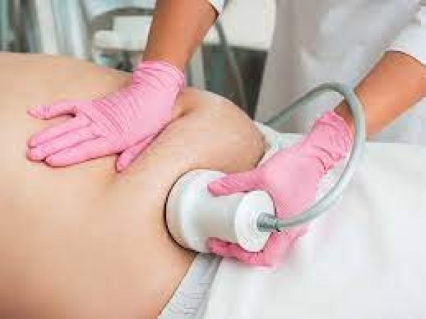 Imagen 9 de servicio