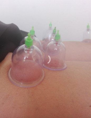 Imagen 3 de servicio