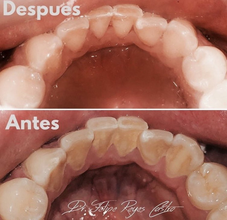 Imagen 2
