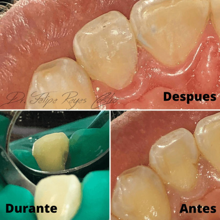 Imagen 3 de servicio