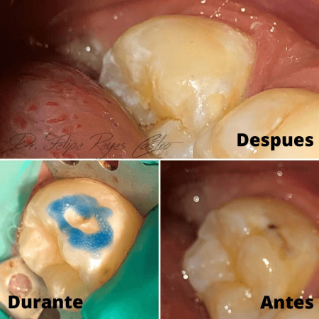 Imagen 4 de servicio