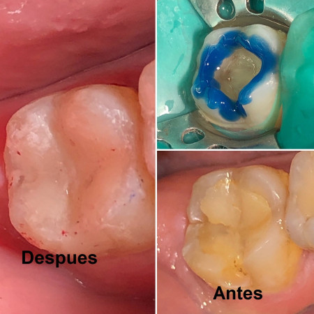 Imagen 6 de servicio