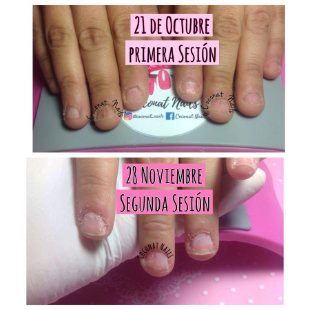 Imagen 6 de servicio