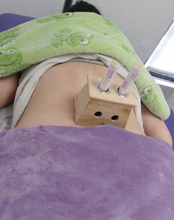 Imagen 4 de servicio