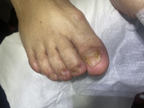 Imagen 8 de servicio