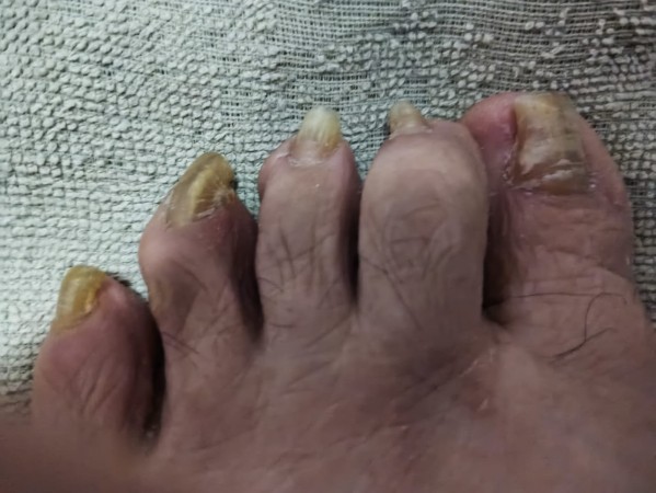 Imagen 9 de servicio