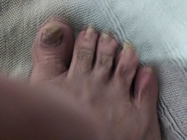 Imagen 10 de servicio