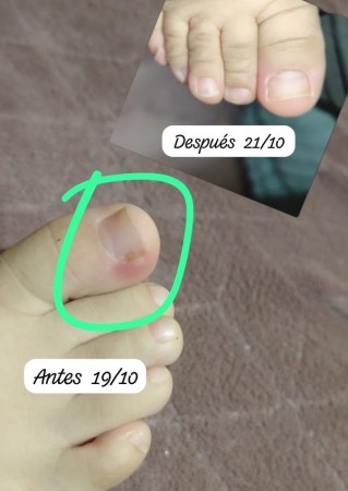 Imagen 12 de servicio