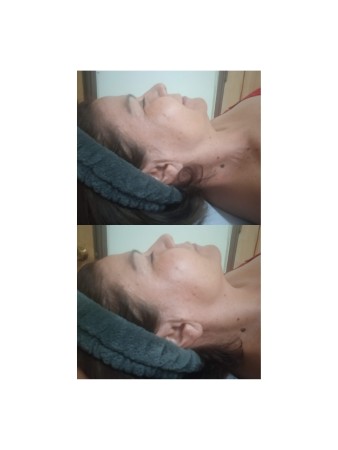 Imagen 4 de servicio