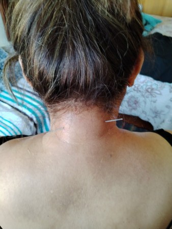 Imagen 4 de servicio