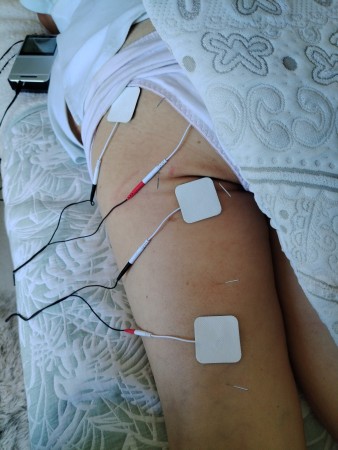 Imagen 15 de servicio
