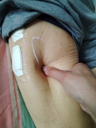 Imagen 20 de servicio