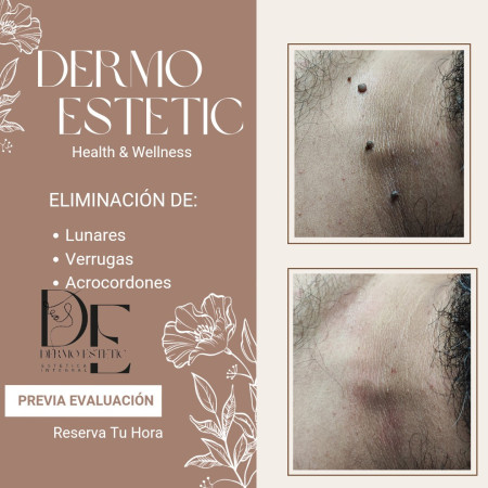 Imagen 3 de servicio