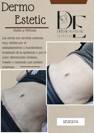 Imagen 4 de servicio