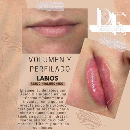 Imagen 7 de servicio