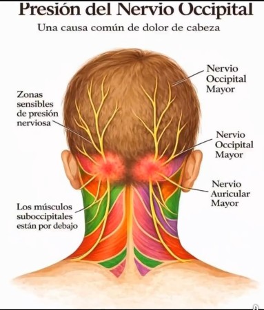 Imagen 46 de servicio