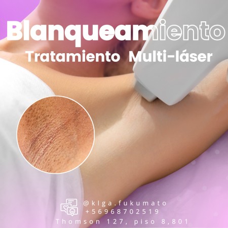 Imagen principal del servicio