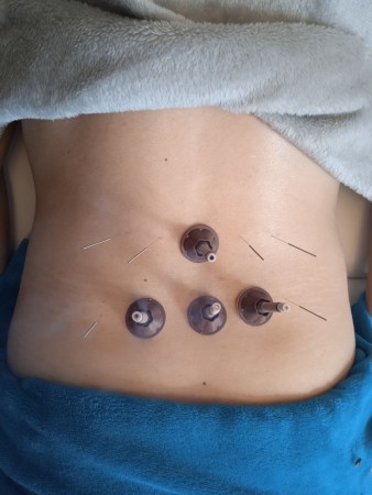 Imagen 5 de servicio