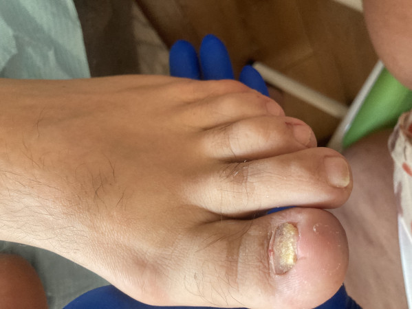 Imagen 5 de servicio