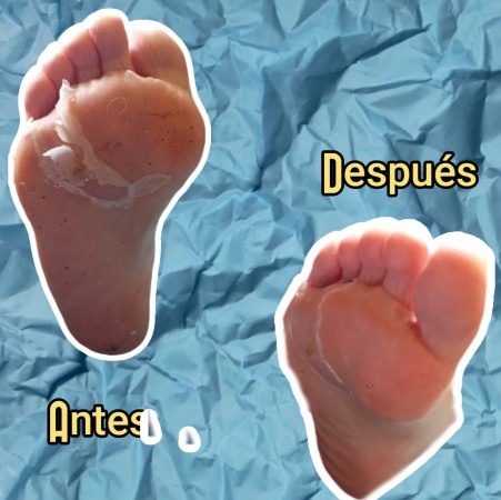 Imagen 3 de servicio
