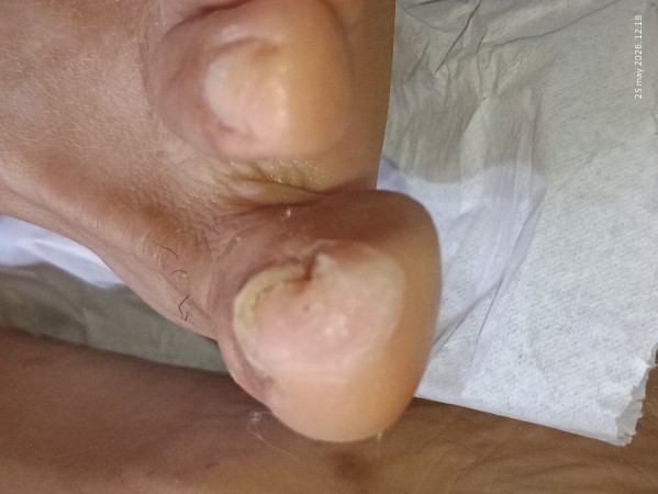 Imagen 17 de servicio