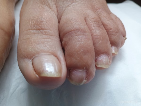Imagen 22 de servicio