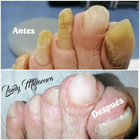 Imagen 4 de servicio