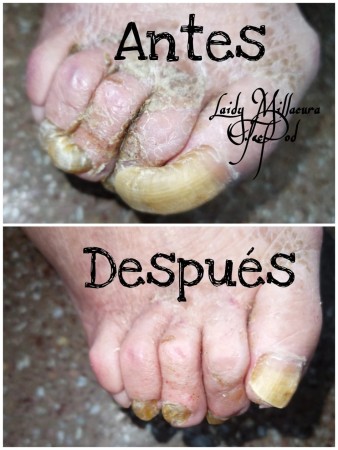 Imagen 3 de servicio