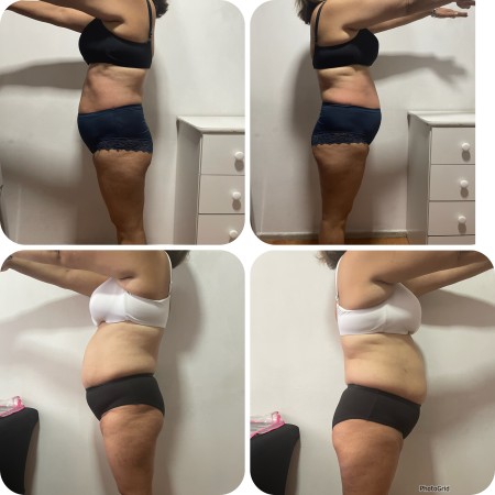 Imagen 4 de servicio