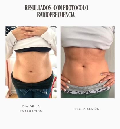 Imagen principal del servicio
