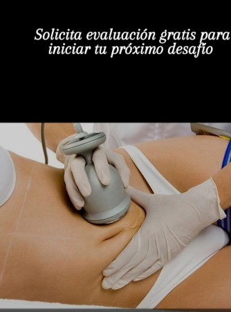 Imagen principal del servicio