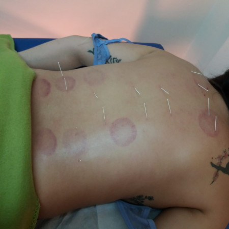 Imagen 4 de servicio