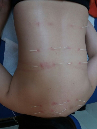 Imagen 6 de servicio