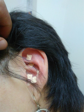 Imagen 7 de servicio