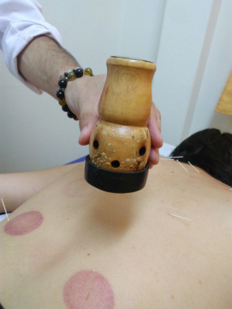 Imagen 9 de servicio