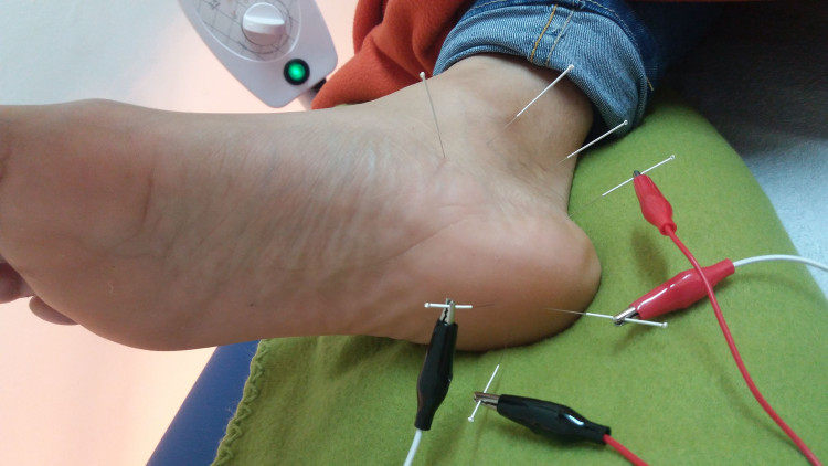 Imagen 14 de servicio