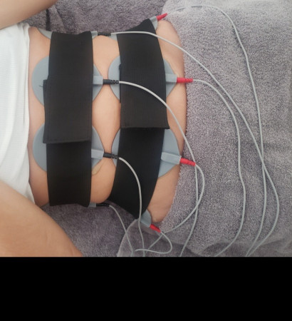 Imagen 10 de servicio