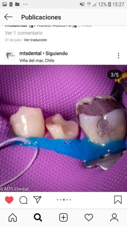 Imagen 3 de servicio