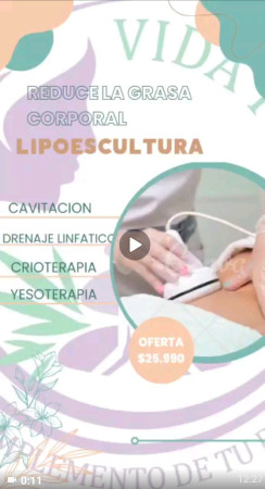 Imagen 11 de servicio
