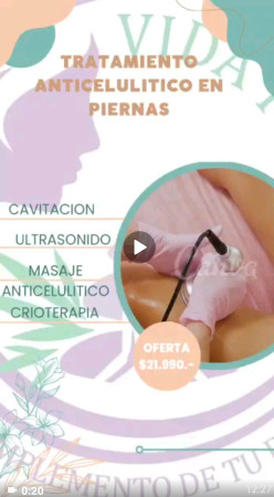 Imagen 17 de servicio