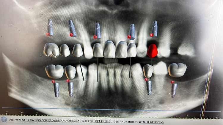 Imagen 8 de servicio
