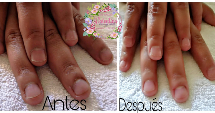 Imagen 8 de servicio