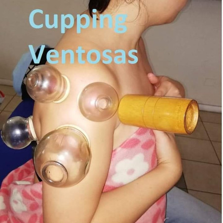 Imagen 2