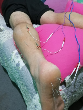 Imagen 6 de servicio